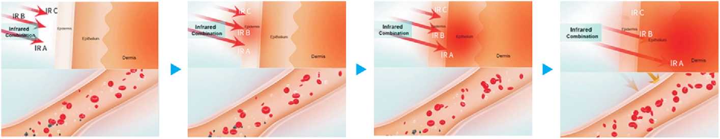 What Benefits We Can Get from Red Light Therapy?