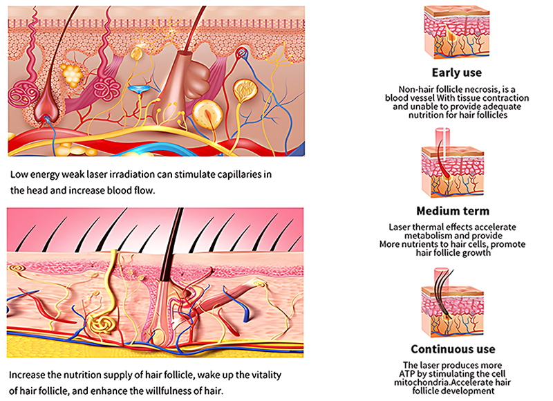 How Does Red Light Therapy Work for Hair Growth?